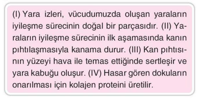 soru gorseli