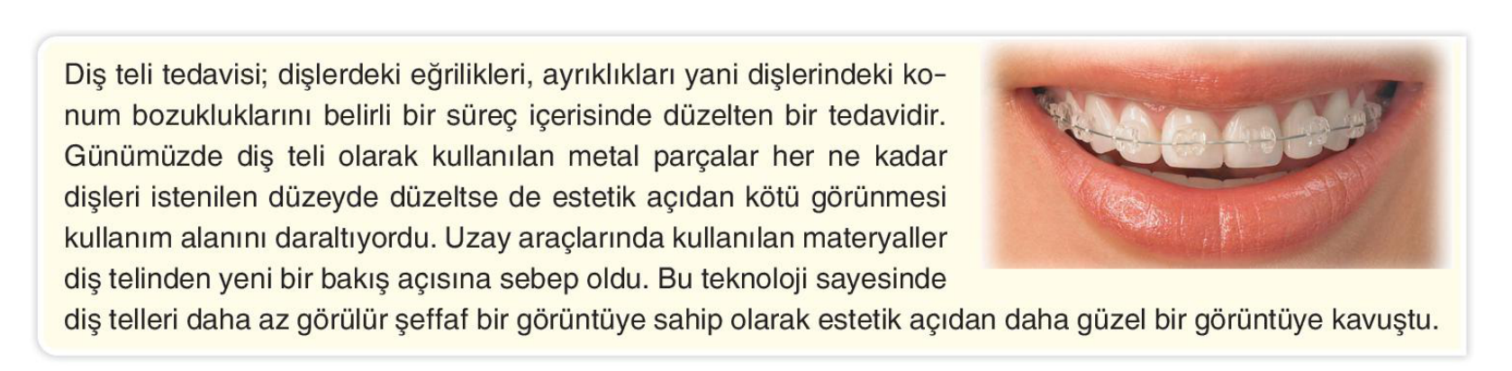 soru gorseli