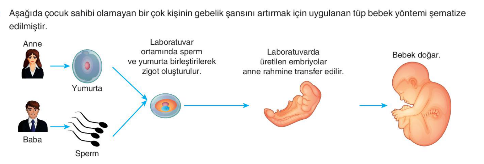 soru gorseli